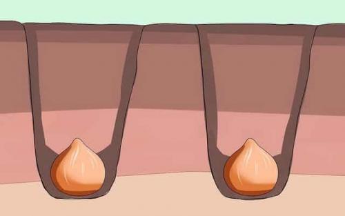 Как вырастить тюльпаны из луковиц дома. Цветущие тюльпаны круглый год. Секрет, как вырастить тюльпаны дома без использования земли 32