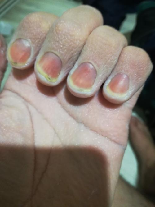 Как сделать шумоизоляцию в квартире без ремонта. В поисках тишины. Или шумоизоляция своими руками.