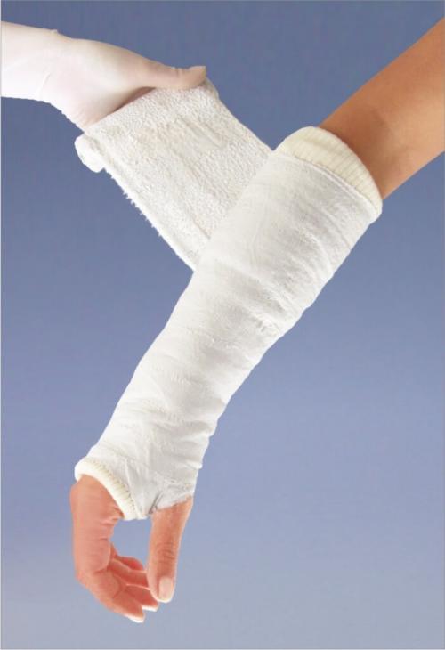 Как сделать гипс в домашних условиях. Наложение гипса 01 Как сделать гипс в домашних условиях. Наложение гипса 01